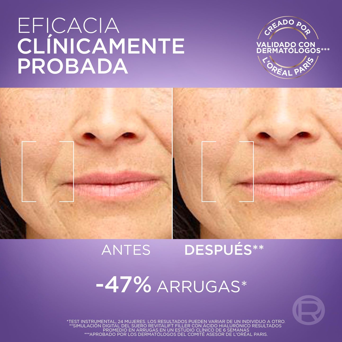 L'Oréal Paris Revitalift Filler Sérum Antiarrugas con Ácido Hialurónico, Péptidos. Nº1 del Mundo. Hidratación Duradera y Profunda. Ilumina y Rellena en 1H. Inspirado en Cosmética Coreana, 30ml