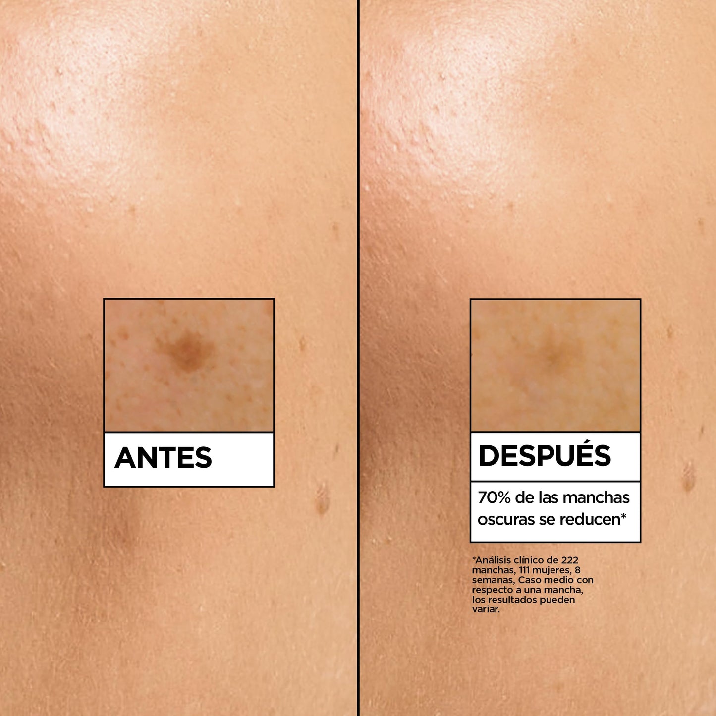 Garnier SkinActive Vitamina C Sérum Antimanchas de Día con 4% de [Vitamina C + Niacinamida + Ácido Salicílico + Melasyl™]. Nº 1 del mundo. Reduce el 70% de las manchas oscuras en solo 5 días. 30 ml