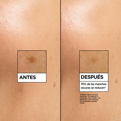 Garnier SkinActive Vitamina C Sérum Antimanchas de Día con 4% de [Vitamina C + Niacinamida + Ácido Salicílico + Melasyl™]. Nº 1 del mundo. Reduce el 70% de las manchas oscuras en solo 5 días. 30 ml